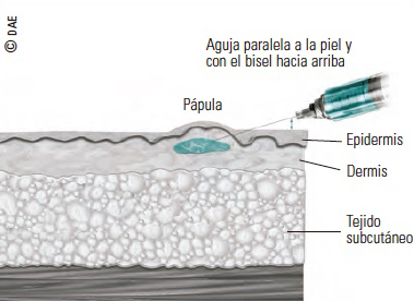 administración de medicamentos vía parental